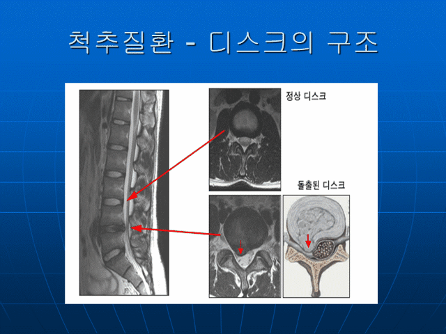 yg6-9 (42).gif