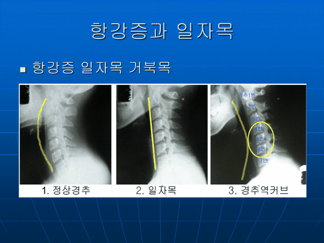 yg6-9 (44).gif